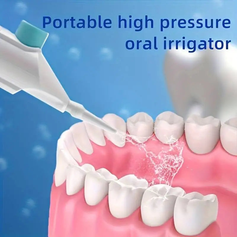 Portable Water Flosser – Manual Oral Irrigator